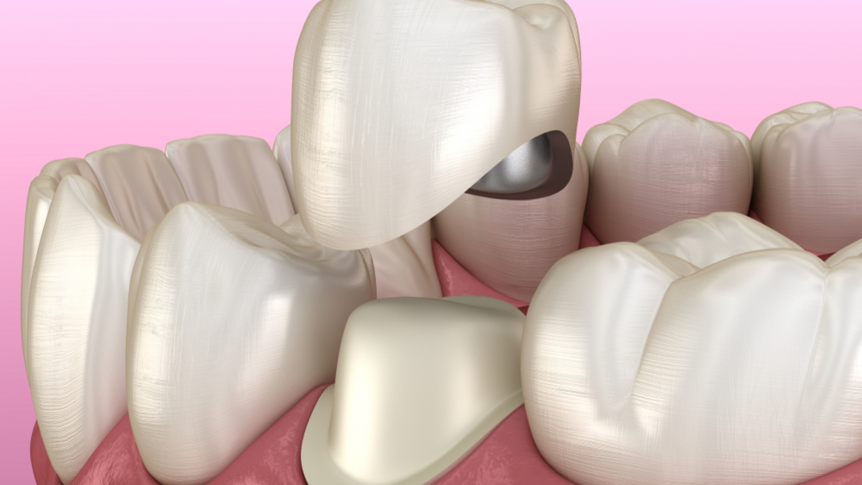 shutterstock_1582204072