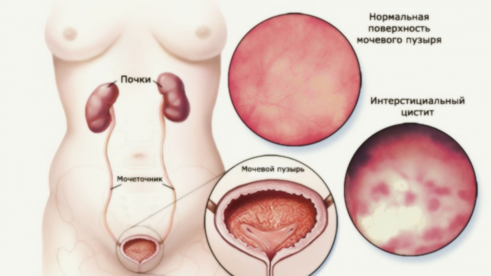 1539720782_22282525925