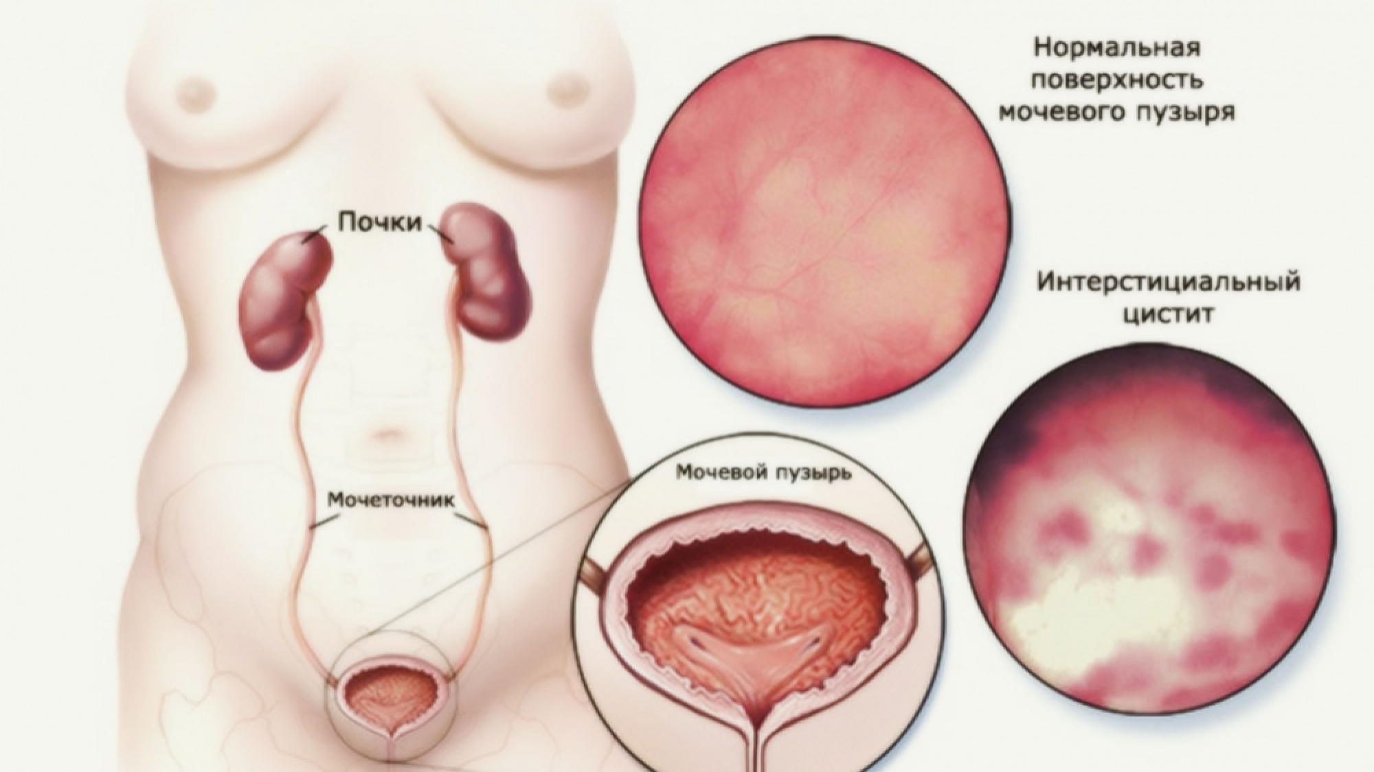 1539720782_22282525925