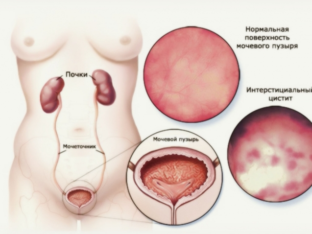 1539720782_22282525925