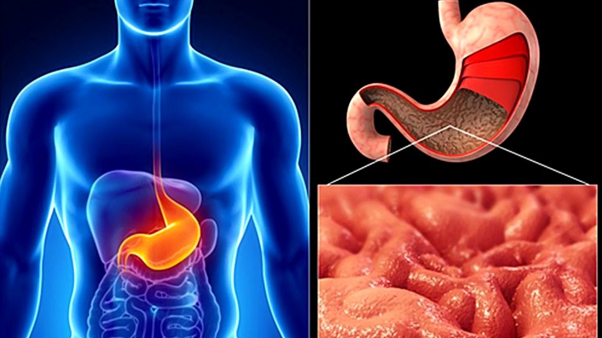 ranitidin-naznachayut-pri-gastrite