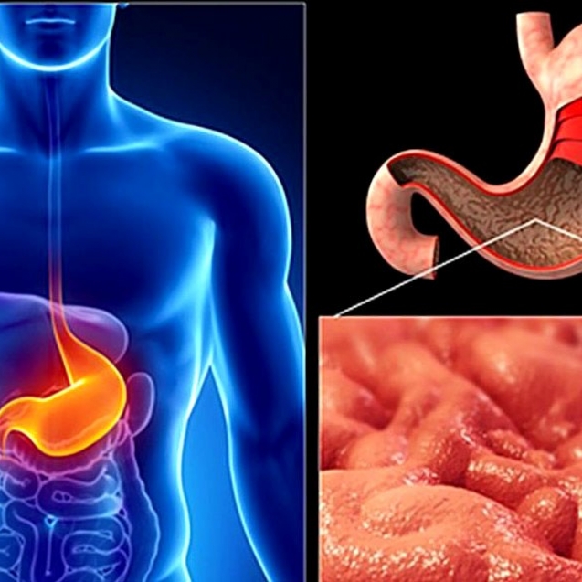 ranitidin-naznachayut-pri-gastrite